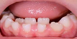 SOS La prima visita dal dentista